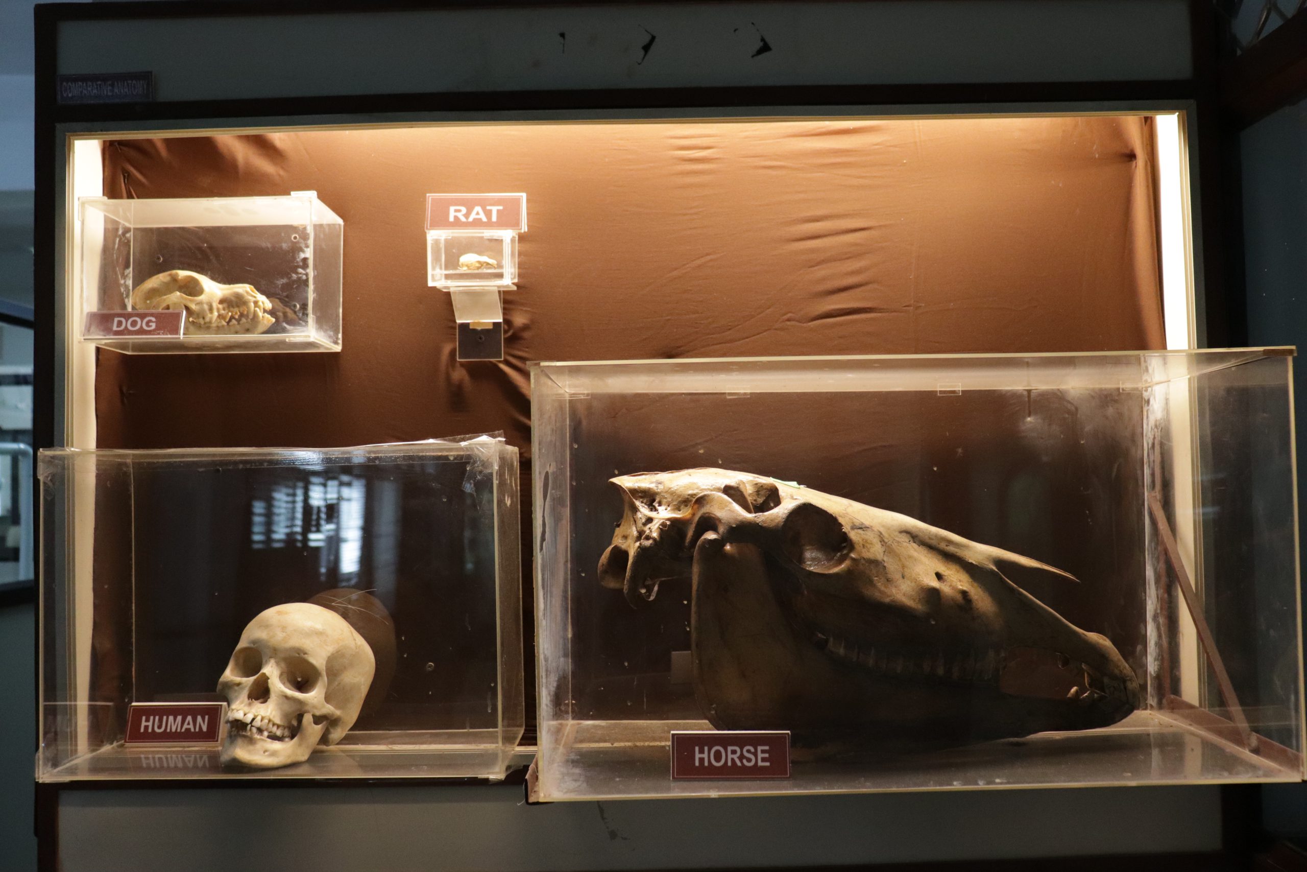 IMG_3467-oralpathology-maxillofacial-pathology-scaled-1